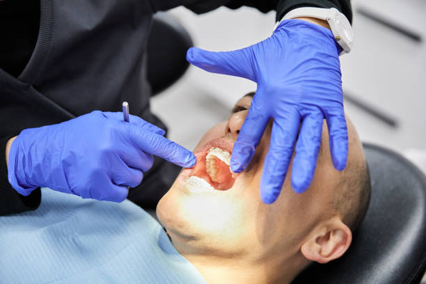 Best Emergency Tooth Extraction in Brier, WA