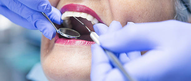 Best Emergency Root Canal Treatment in Brier, WA